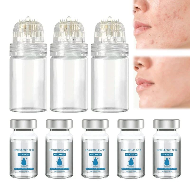 Micro Infusion System Pack of 3 Face Lip Fix Micro Infusion Lipfix Micro Infusion Serum Glov Micro Infusion System Suitable for Smooth Face Skin and Improve Face Lines