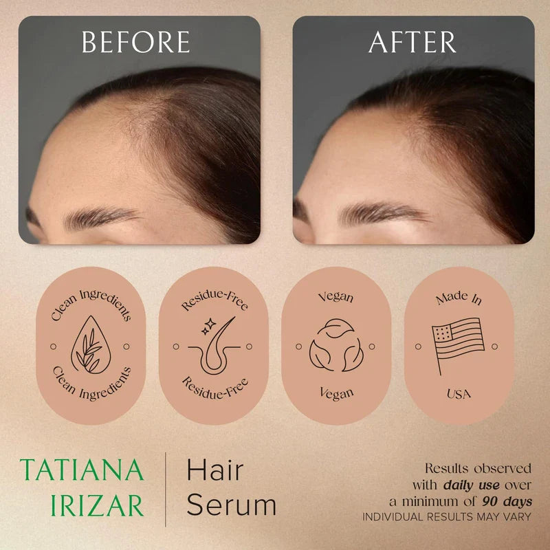 Tatiana Irizar Hair Serum for Hair Growth Serum Women Made in USA - 2 Pack Scalp Serum for Hair Growth Non-Greasy Rosemary & Amla Hair Care Vegan 1 Oz Hair Loss Treatment for Women Hair Regrowth Treatment for Women