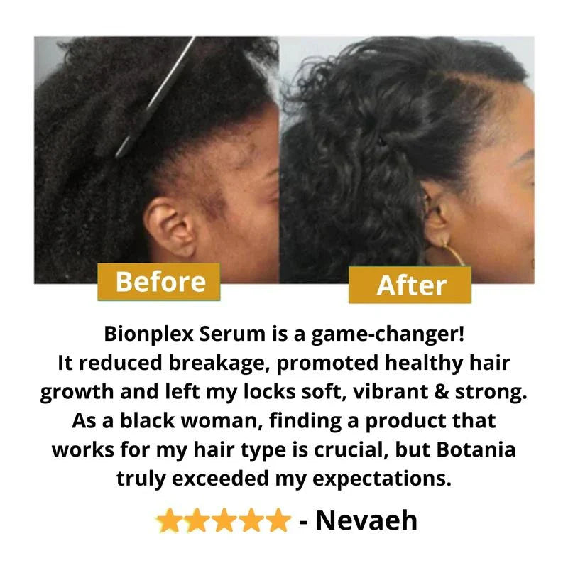 BIONPLEX 100% Organic Hair Growth Serum For Thinning Hair Loss - More Bottles:: 6 Pics