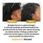 BIONPLEX 100% Organic Hair Growth Serum For Thinning Hair Loss - More Bottles:: 6 Pics