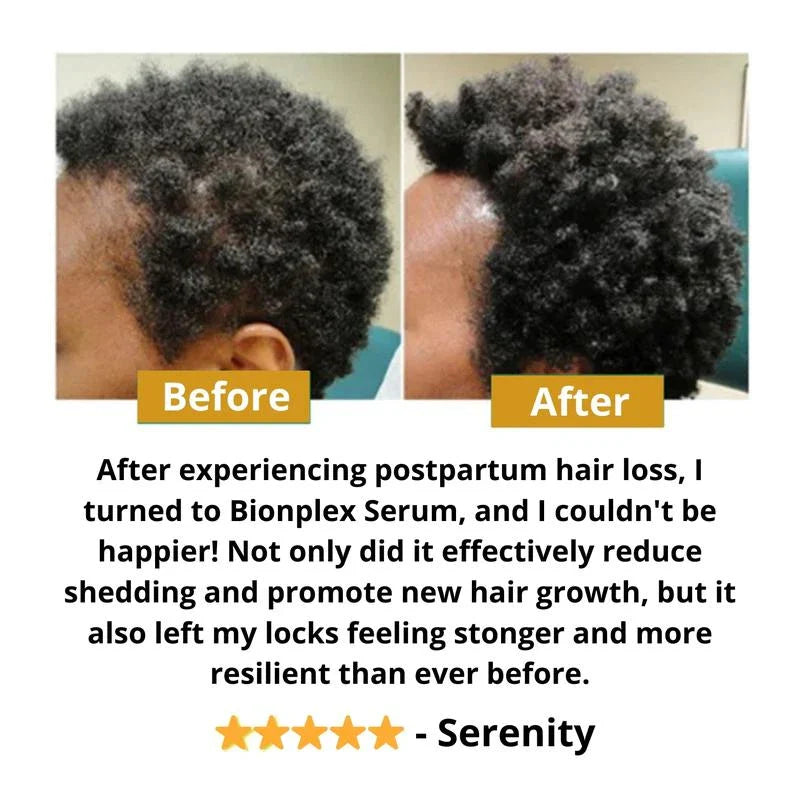 BIONPLEX 100% Organic Hair Growth Serum For Thinning Hair Loss - More Bottles:: 1 Pics