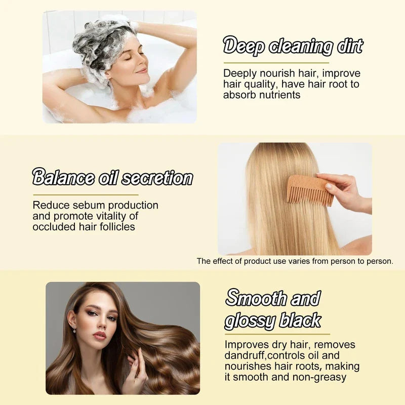 YCNASSS 2PCS Ginger Plant Extract Anti-Hair Loss Hair Shampoo,Identicalven Hair Loss Shampoo, Anti-Dandruff Shampoo, Polygonum Multiflorum Oil Control Shampoo for Hair Growth