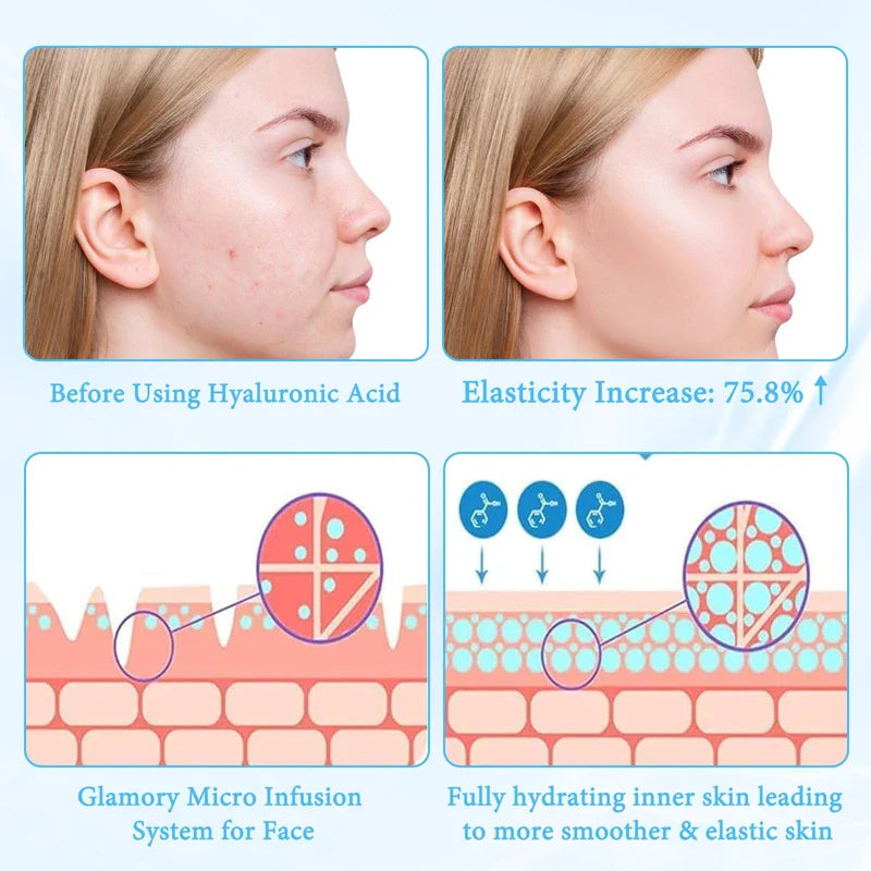 Micro Infusion System Pack of 3 Face Lip Fix Micro Infusion Lipfix Micro Infusion Serum Glov Micro Infusion System Suitable for Smooth Face Skin and Improve Face Lines